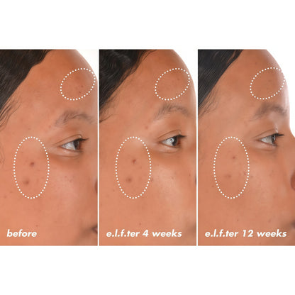 e.l.f. SKIN Bright lcon Vitamin C + E +Ferulic Serum, Brightening & SoothingFace Serum, Helps Even Skin Tone,Vegan & Cruelty-Free, 1 fl oz（2pack）